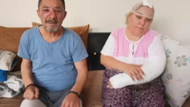 Fotoğrafta, bir erkek ve kadın yan yana oturuyor. Erkek ve kadın da darp edilmiş. Kadının kafasında sargı bezi var ve kolu da alçıya alınmış. Aynı zamanda yüzlerinde ise morarmalar var.