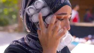 Beyza Aydın, yüzünde bir buz torbası tutarak yanan yerin hasarını gidermeye çalışıyor.