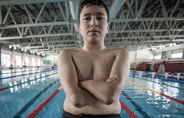 Fotoğraf, bir yüzme havuzunun kenarında duran genç bir sporcuyu göstermektedir. 15 yaşında olduğu belirtilen çocuk, doğuştan kolları ve ayakları olmamasına rağmen kararlı bir duruş sergiliyor. Geniş bir açıyla çekilen bu karede, çocuğun çıplak üst vücudu, güçlü duruşu ve kendine güveni ön planda. Arkada modern bir yüzme havuzu, mavi su, renkli kulvar ayırıcıları ve çelik konstrüksiyon çatı dikkat çekiyor. Çocuğun yüzündeki ciddi ifade, azim ve kararlılığı yansıtıyor. Bu sahne, fiziksel engellerin aşılabileceğini ve spora olan tutkuyu güçlü bir şekilde simgeliyor.
