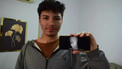 Yusuf Emre Özbek, elinde tuttuğu telefon ekranında bulunan başındaki yorgun mermi röntgenini gösteriyor.