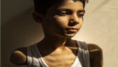 Mahmoud Ajjour’un, beyaz askılı atletli kolları amputeli portre fotoğrafı.