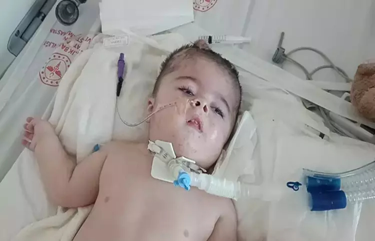 Ayaz bebek boğazına takılı hortumla yatakta uzanıyor.