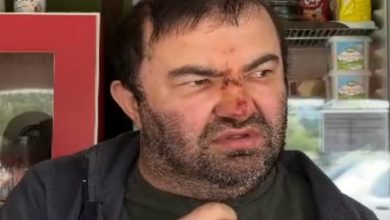 Darp edilen engelli birey Murat Kepil'in şiddet sonrası şişen burnu kanlar içinde.