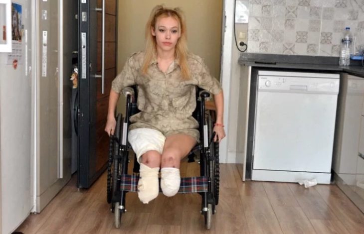 İrem Karatutlu'nun tekerlekli sandalye kullanıyor ve ampute edilen bacakları sargı içinde.