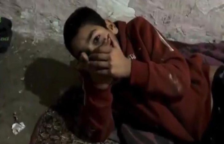 İki eliyle ağzını tutan engelli çocuk.