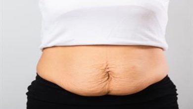 Beyaz bir arka plan önünde, bir kişinin alt karın bölgesi yakın plandan görülüyor; doğum sonrası oluşan gevşeme ve bombelik net şekilde dikkat çekiyor.
