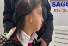 Görselde, yüzü gizlenmiş küçük bir kız çocuğu profilden görülüyor. Sağ kulak bölgesinde doğuştan gelişim farklılığı dikkat çekiyor. Yanında bir yetişkin destek amaçlı dururken, arka planda bir sağlık kurumuna ait tabela bulunuyor. Ortam, bir muayene ya da hastane sürecini çağrıştırıyor.