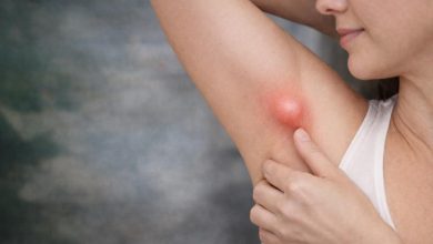 Bir kadın koltuk altını kaldırmış, parmağıyla kızarık ve şiş bir bölgeyi işaret ediyor. Şişlik belirgin, yuvarlak ve iltihaplı gibi görünüyor; çevresi hafif kızarmış. Görsel, koltuk altındaki ağrılı bir şişliği ya da enfeksiyonu çağrıştırıyor.