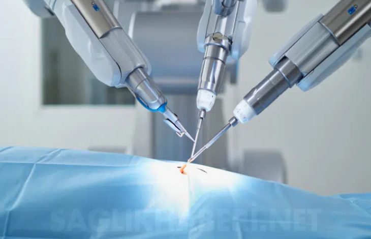 Görselde, modern bir ameliyathane ortamında robotik cerrahi müdahale anı betimleniyor. Üç adet ileri teknoloji ürünü metalik robotik kol, mavi bir örtüyle kaplı hastanın vücudundaki tek bir küçük kesi noktasına (single-port) odaklanmış durumda. Kolların uçlarındaki hassas cerrahi aletler, operasyonun gerçekleştiği noktada birleşiyor. Arka planda ise tıbbi cihazların bulanık, steril ve beyaz ağırlıklı detayları görülüyor.