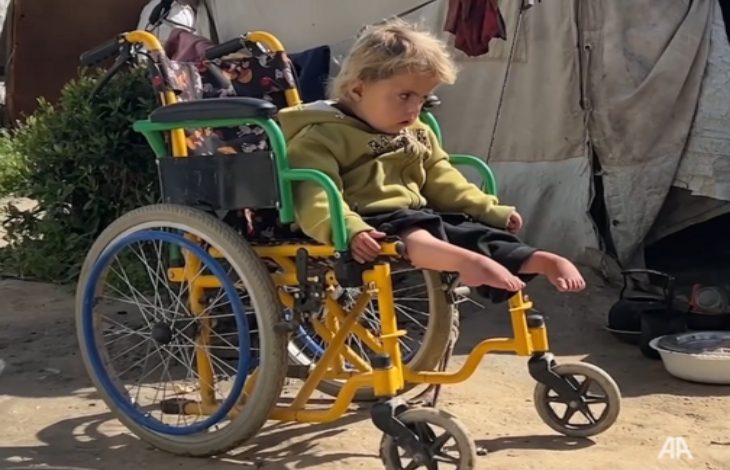 İsrail saldırılarında yaralanan Kamer Muhammed Hacci, tekerlekli sandalyede oturuyor.