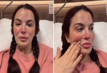 Görselde, oyuncu Aslı Bekiroğlu hasta yatağında yatıyor.