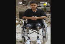 Yıkılmış binaların enkazı önünde çekilen fotoğrafta, tekerlekli sandalyede oturan genç bir erkek kameraya konuşuyor. Her iki bacağında protez bulunan genç, siyah kıyafetler içinde ciddi bir ifadeyle objektife bakıyor. Görsel, 6 Şubat depremlerinin ardından hayatta kalma mücadelesi veren bir bireyin yaşadığı ağır kayıpları ve direnci yansıtıyor.
