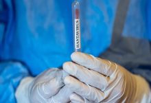 Görselde, koruyucu tıbbi eldiven giymiş bir kişinin elleri arasında üzerinde "HANTAVIRUS" yazılı bir test tüpü tuttuğu görülmektedir. Arka planda ise mavi bir koruyucu tulum bulunmaktadır; bu kompozisyon ciddi bir sağlık durumunu veya laboratuvar çalışmasını simgelemektedir.