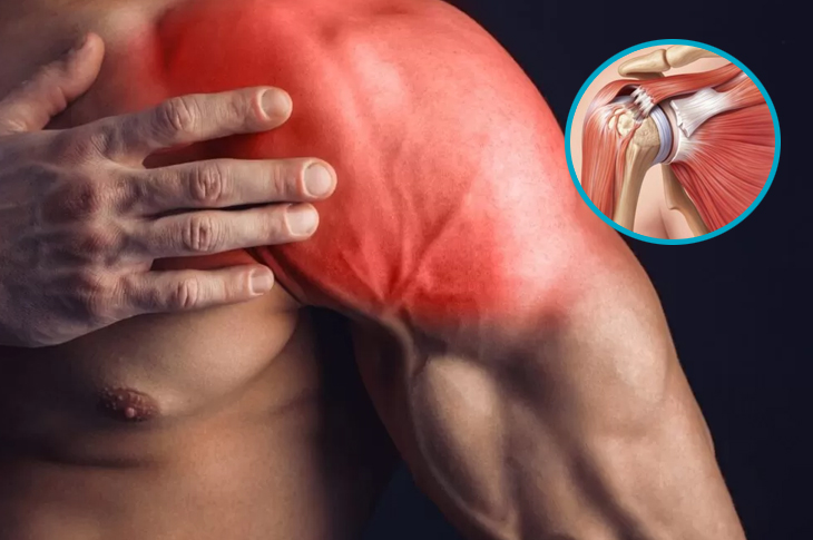Omuz Tendon Yırtıklarında Erken Tanı ve Tedavi Önemli