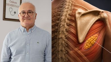 Solda, gözlüklü ve açık mavi gömlekli Göğüs Cerrahisi Uzmanı Prof. Dr. Özkan Demirhan ayakta duruyor. Sağda ise kürek kemiği ve çevresindeki kasları gösteren ayrıntılı bir anatomik çizim bulunuyor; çizimde Elastofibroma Dorsi’nin yerleştiği bölge sarı tonlarda işaretlenmiş.