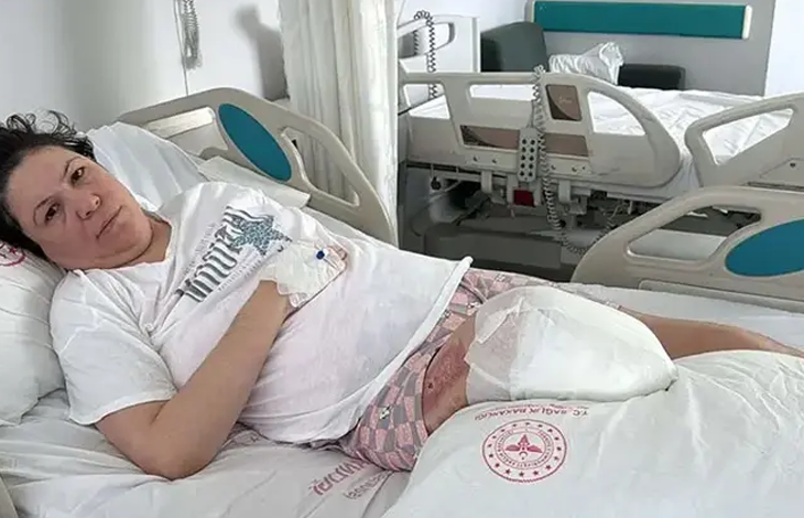 Instagram İçin Alternatif Metin (Kadına Şiddet ve Amputasyon Haberi): Görselin üst bölümünde, hastane odasındaki hasta yatağında yatan ve eşinin saldırısı sonucu iki bacağını da kaybeden mağdur kadın yer alıyor. Beyaz tişört giymiş ve elinde damar yolu/serum kelebeği takılı olan kadın, yastığa yaslanmış biçimde üzgün ve bitkin bir ifadeyle doğrudan objektife bakıyor. Bacak bölgesinde ameliyat sonrası kalın beyaz sargı ve pansuman bezleriyle sarılmış ampute edilmiş uzuv görülüyor; üzerindeki çarşaf ve yastık kılıfında kırmızı T.C. Sağlık Bakanlığı amblemi yer alırken, arka planda odadaki diğer boş hasta yatağı ve tıbbi donanımlar seçiliyor.