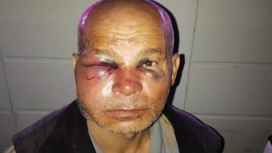Muhammed Sonbaş'ın yüzünün özellikle sol göz çevresinde belirgin şişlik, morarma ve kesik bulunan, ciddi şekilde yaralanmış görülüyor.