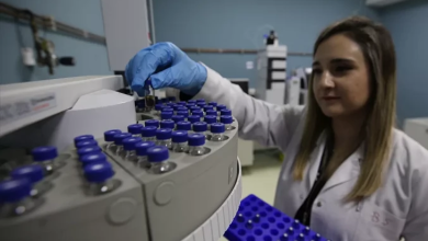 Bir sağlık çalışanı laboratuvarda beyaz önlük ve mavi eldivenlerle küçük numune tüplerini dikkatle yerleştiriyor. Önünde dairesel bir örnek tepsisi ve analiz cihazı bulunuyor; ortam steril ve profesyonel bir çalışma alanı hissi veriyor.