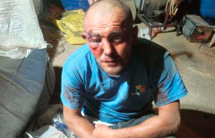 Sosyal medya fenomeni Selçuk Demir'in darp edildikten sonra yüzü kanlar içinde buzlanmış fotoğrafı.